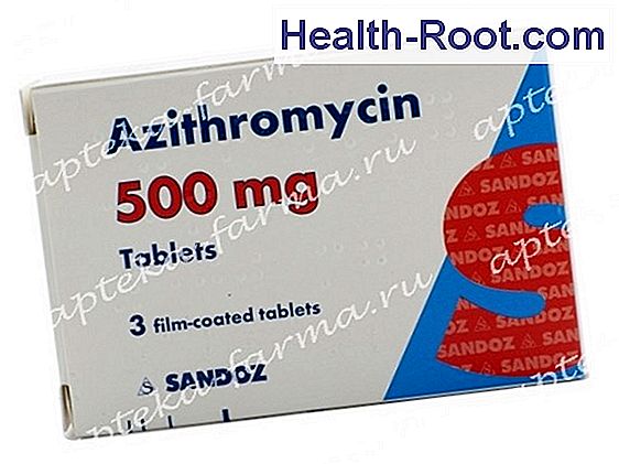 azitromicin ízületi gyulladás)