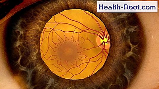 látás glaukóma után az észlelés és az érzékelés látássérült jellemzői