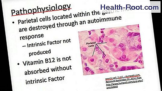 Vitamin B12 and anemia (pernicious anemia) 🏥 Disease, Symptoms