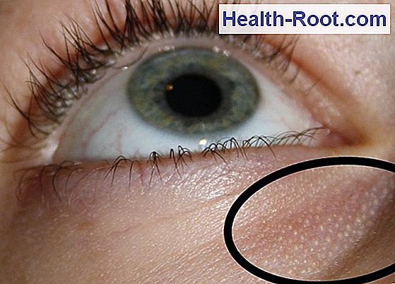 Schwarze Flecken Vor Dem Auge health-root.com