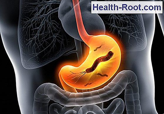 Wie Wird Ein Magengeschwür Behandelt health-root.com
