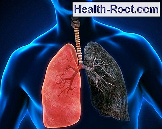 Chronic Obstructive Pulmonary Disease Copd Copd Australian 