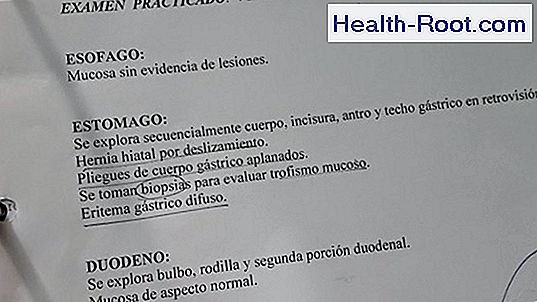 alimentos para curar la anemia perniciosa alimentos para curar la anemia perniciosa