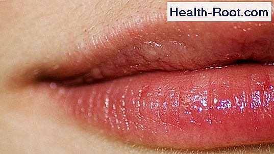 q es un herpes labial
