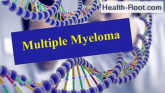 súlycsökkenés myeloma multiplex)