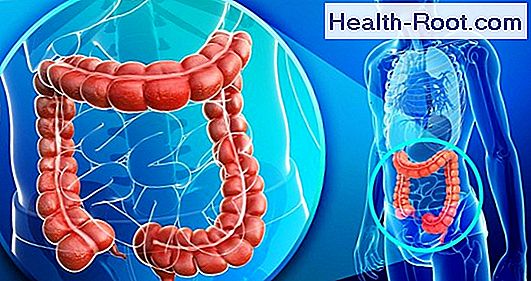 Infiammazione Cronica Intestinale Malattia Di Crohn La Malattia I