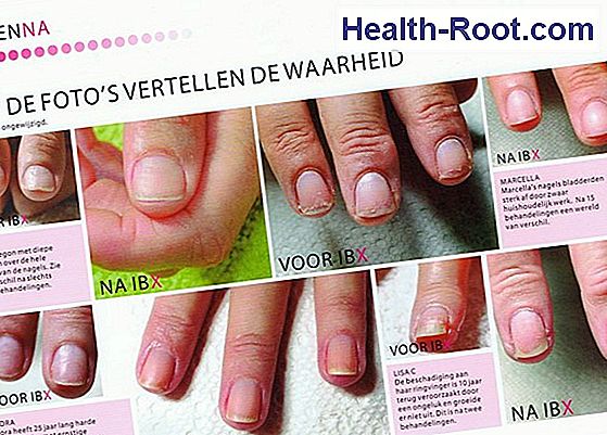 Zoladex LA Ziekte Symptomen Behandeling 2022